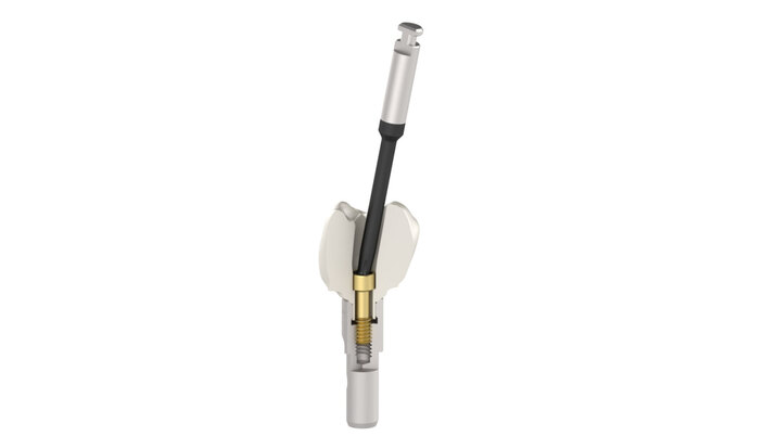 TPA System - Angled Screw correction