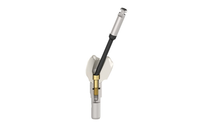 TPA System - Angled Screw correction